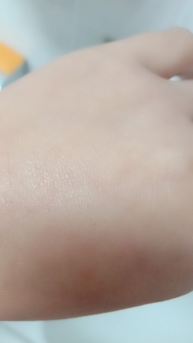 蘭亭玻尿酸原液好用嗎安全嗎，真實(shí)使用體驗(yàn)(補(bǔ)水/保濕/安全)